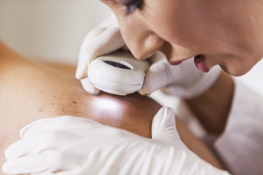 Diagnose and Treat Skin Cancer