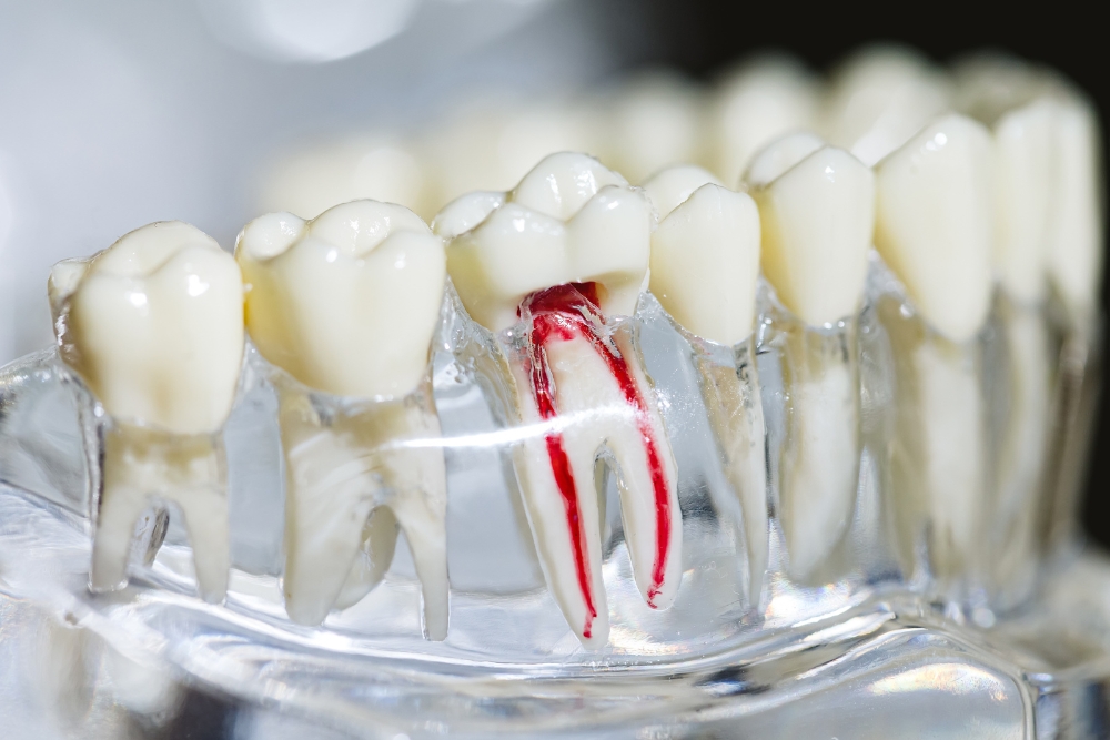 Signs You Might Need a Root Canal Signs You Might Need a Root Canal