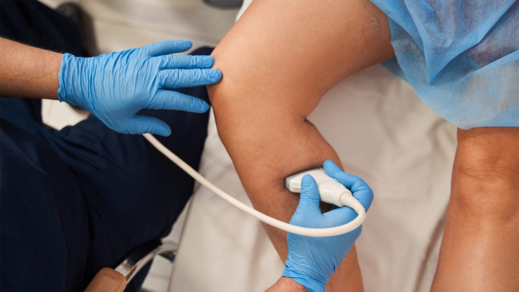 How Vein Specialists Diagnose and Treat Venous Thrombosis Venous Thrombosis