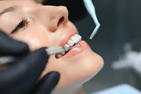 How a Cosmetic Dentist Creates Natural Results Cosmetic Dentist