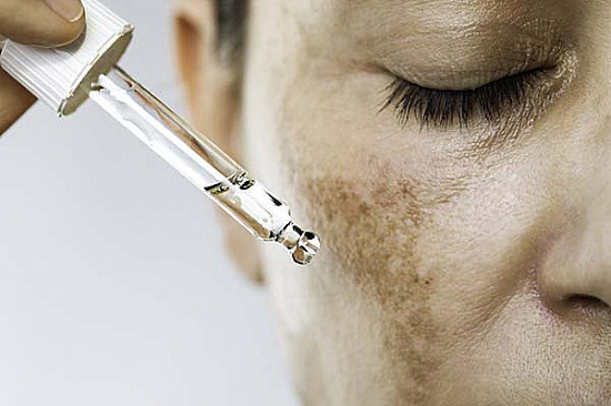 How a Dermatologist Can Help with Hyperpigmentation Dermatologist Can Help with Hyperpigmentation