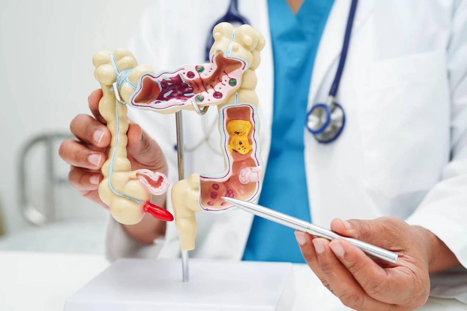 Signs and Symptoms of Colon Cancer You Shouldn’t Ignore Signs and Symptoms of Colon Cancer