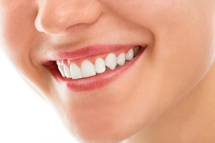 What To Know About Cosmetic Teeth Whitening Cosmetic Teeth Whitening