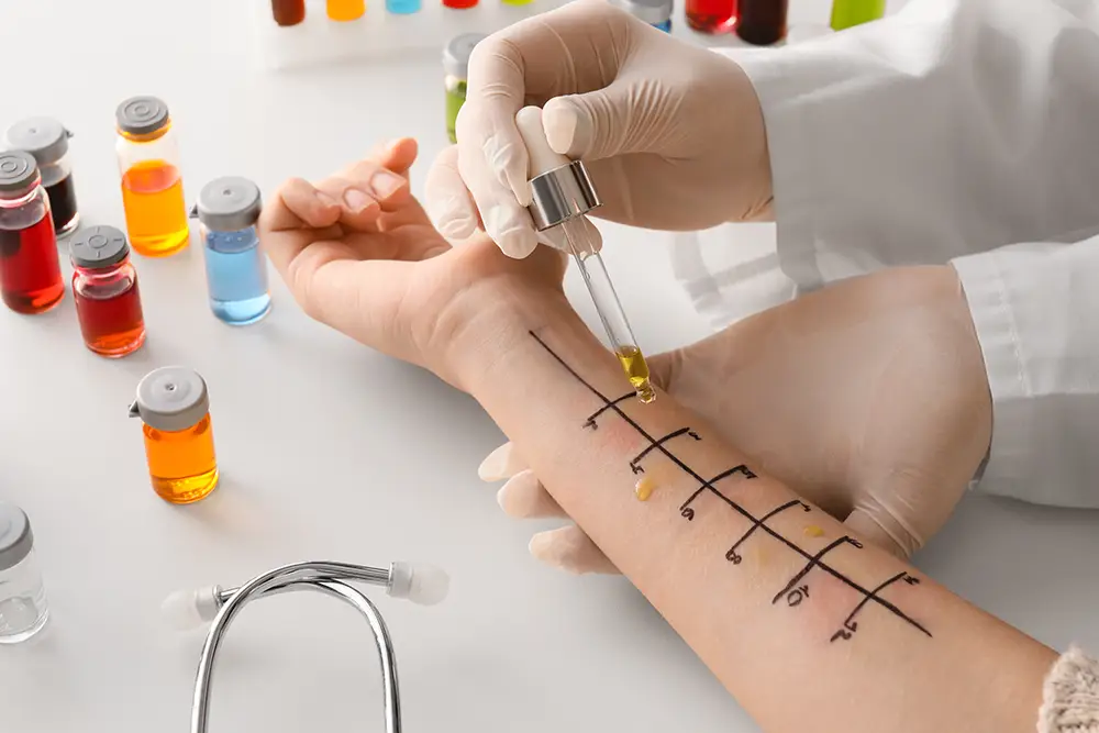 What You Should Know About Allergy Testing Allergy Testing